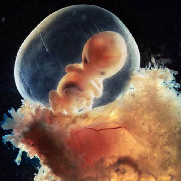 15-Eight weeks.The rapidly-growing embryo is well protected in the foetal sac